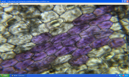 Cellule vegetali _peduncolo di Bella di Notte_10 x